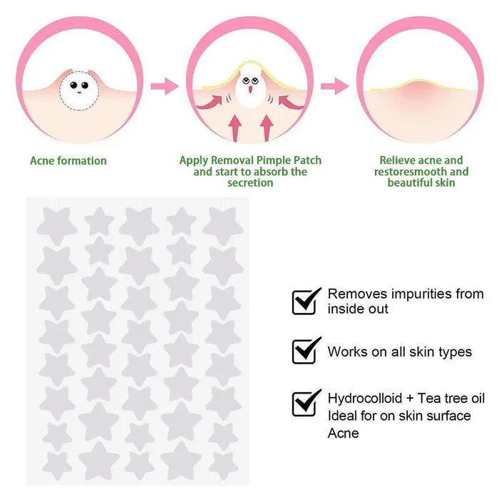 40Pcs/sheet Colorful Cute Star Heart Shaped Treatment Sticker Invisible Cover Removal Pimple Patch Skin Care