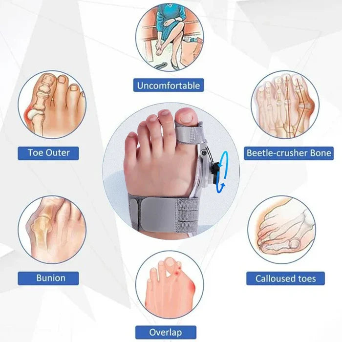 Bunion Corrector Braces