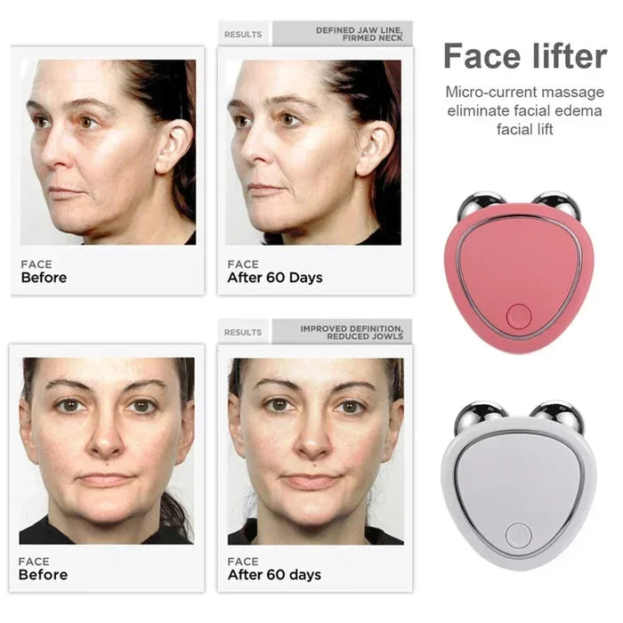Electric Face Lift Roller