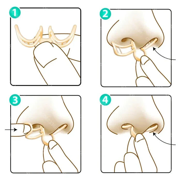 Snore Stopper Nasal Dilator